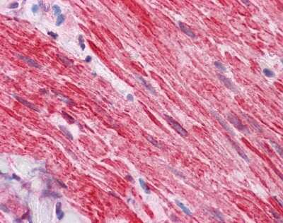 Immunohistochemistry-Paraffin: Dishevelled 2 Antibody [NBP1-58849] - Human Small intestine, muscularis propria, 5 ug/ml.