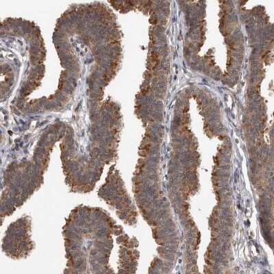 Immunohistochemistry-Paraffin: Dishevelled-2 Antibody [NBP1-87550] - Staining of human fallopian tube shows strong cytoplasmic positivity in glandular cells.