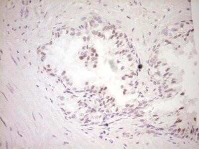 Immunohistochemistry: Dishevelled-2 Antibody (OTI2D11) - Azide and BSA Free [NBP2-70611] - Analysis of Human prostate tissue. (Heat-induced epitope retrieval by 1 mM EDTA in 10mM Tris, pH8.5, 120C for 3min)