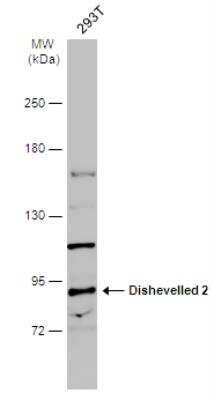 Western Blot: Dishevelled-2 Antibody [NBP1-32388] - Whole cell extract (50 ug) was separated by 5% SDS-PAGE, and the membrane was blotted with Dishevelled-2 antibody Internal diluted at 1:500. The HRP-conjugated anti-rabbit IgG antibody was used to detect the primary antibody, and the signal was developed with Trident ECL plus-Enhanced.