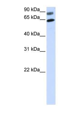 Western Blot: Dishevelled 2 Antibody [NBP1-58849] - Titration: 0.2-1 ug/ml, Positive Control: Transfected 293T.