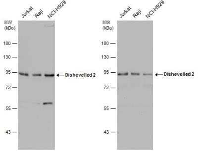 <b>Independent Antibodies Validation. </b>Western Blot: Dishevelled-2 Antibody [NBP2-16168] - Various whole cell extracts (30 ug) were separated by 7.5% SDS-PAGE, and the membranes were blotted with Dishevelled 2 antibody [N1N3]. HRP-conjugated anti-rabbit IgG antibody was used to detect the primary antibody