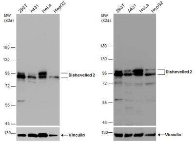 <b>Independent Antibodies Validation. </b>Western Blot: Dishevelled-2 Antibody [NBP2-16168] - Various whole cell extracts (30 ug) were separated by 7.5% SDS-PAGE, and the membranes were blotted with Dishevelled 2 antibody [N1N3].