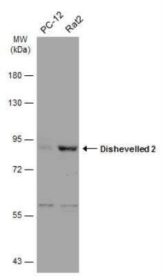 Western Blot: Dishevelled-2 Antibody [NBP2-16168] - Various whole cell extracts (30 ug) were separated by 7.5% SDS-PAGE, and the membrane was blotted with Dishevelled-2 antibody diluted at 1:5000. HRP-conjugated anti-rabbit IgG antibody was used to detect the primary antibody.