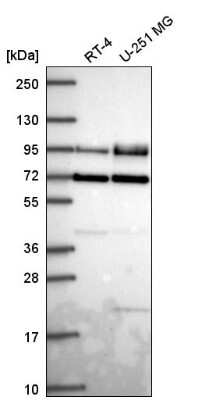 Western Blot: Dishevelled-2 Antibody [NBP2-56345] - Western blot analysis in human cell line RT-4 and human cell line U-251 MG.