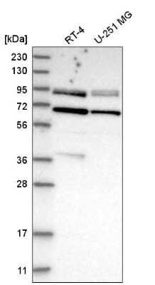 Western Blot: Dishevelled-2 Antibody [NBP2-58480] - Western blot analysis in human cell line RT-4 and human cell line U-251 MG.