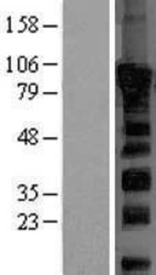 Western Blot: Dishevelled 2 Overexpression Lysate (Adult Normal) [NBL1-10063] Left-Empty vector transfected control cell lysate (HEK293 cell lysate); Right -Over-expression Lysate for Dishevelled 2.