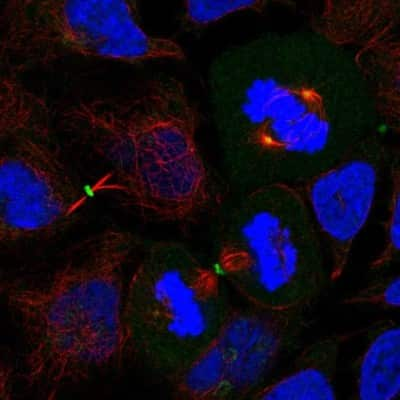 Immunocytochemistry/Immunofluorescence: Dishevelled-3 Antibody [NBP2-38846] - Staining  of human cell line CACO-2 shows positivity in cytokinetic bridge and centrosome.