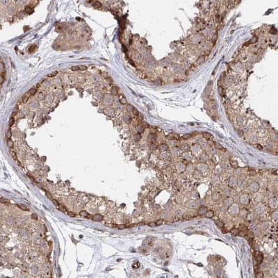 Immunohistochemistry-Paraffin: Dishevelled-3 Antibody [NBP2-38846] - Staining of human testis shows moderate cytoplasmic positivity in cells in seminiferous ducts.