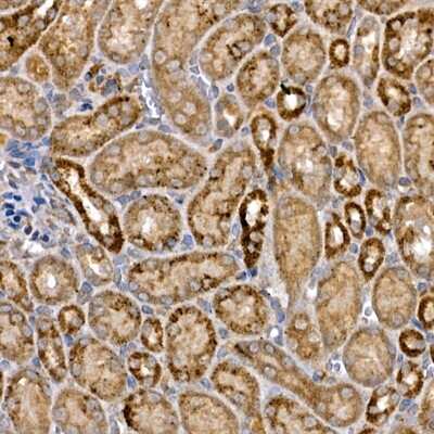 Immunohistochemistry-Paraffin: Dishevelled-3 Antibody [NBP3-03068] - Immunohistochemistry of paraffin-embedded mouse kidney using Dishevelled-3 Rabbit pAb (NBP3-03068) at dilution of 1:150 (40x lens). Perform high pressure antigen retrieval with 10 mM citrate buffer pH 6.0 before commencing with IHC staining protocol.