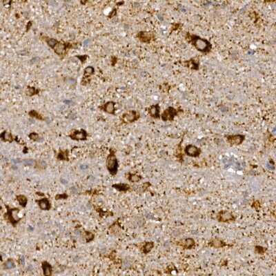 Immunohistochemistry-Paraffin: Dishevelled-3 Antibody [NBP3-03068] - Immunohistochemistry of paraffin-embedded rat brain using Dishevelled-3 Rabbit pAb (NBP3-03068) at dilution of 1:150 (40x lens). Perform high pressure antigen retrieval with 10 mM citrate buffer pH 6.0 before commencing with IHC staining protocol.