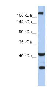 Western Blot: Dispatched Antibody [NBP1-59442] - Human Small Intestine, concentration 0.2-1 ug/ml.
