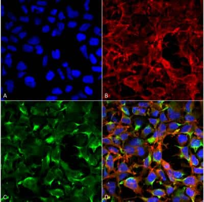 Immunocytochemistry/Immunofluorescence: Dityrosine Antibody (7D4) [NBP2-59360] - Tissue: Embryonic kidney cells (HEK293) cultured overnight with 50 uM H2O2. Species: Human. Fixation: 5% Formaldehyde for 5 min. Primary Antibody: Mouse Anti-Dityrosine Monoclonal Antibody  at 1:50 for 30-60 min at RT. Secondary Antibody: Goat Anti-Mouse Alexa Fluor 488 at 1:1500 for 30-60 min at RT. Counterstain: Phalloidin Alexa Fluor 633 F-Actin stain; DAPI (blue) nuclear stain at 1:250, 1:50000 for 30-60 min at RT. Localization: Cytoplasmic. Magnification: 20X (2X Zoom). (A) DAPI (blue) nuclear stain. (B) Phalloidin Alex Fluor 633 F-Actin stain. (C) Dityrosine Antibody (D) Composite. Courtesy of: Dr. Robert Burke, University of Victoria.