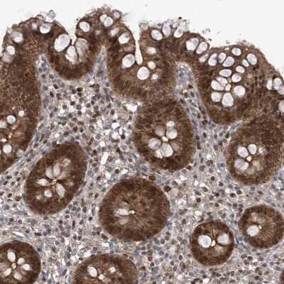 Immunohistochemistry-Paraffin: DjC9 Antibody [NBP1-87903] - Staining of human appendix shows strong cytoplasmic and nuclear positivity in glandular cells.