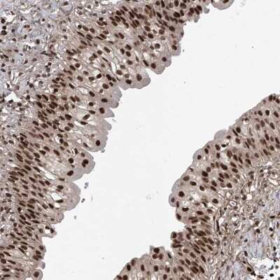 Immunohistochemistry-Paraffin: DjC9 Antibody [NBP2-33997] - Staining of human urinary bladder shows strong nuclear positivity in urothelial cells.