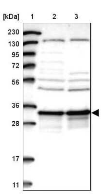 Western Blot: DjC9 Antibody [NBP2-33997] - Lane 1: Marker [kDa] 230, 130, 95, 72, 56, 36, 28, 17, 11Lane 2: Human cell line RT-4Lane 3: Human cell line U-251MG sp