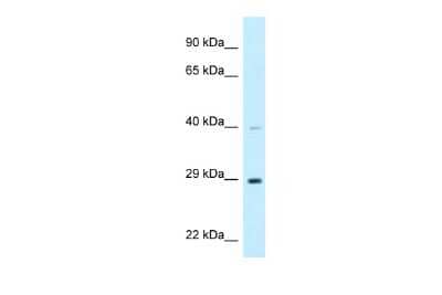 Western Blot: DjC9 Antibody [NBP2-87273] - WB Suggested Anti-DNAJC9 Antibody. Titration: 1.0 ug/ml. Positive Control: 721_B Whole CellDNAJC9 is strongly supported by BioGPS gene expression data to be expressed in Human 721_B cells