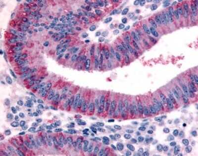 Immunohistochemistry-Paraffin: Dkk-1 Antibody [NB110-40442] - Analysis of anti-DKK1 antibody with human uterus, endometrium.