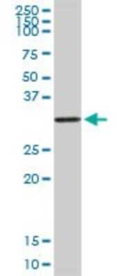 Western Blot: Dlx1 Antibody [H00001745-D01P] - Analysis of DLX1 expression in human liver.