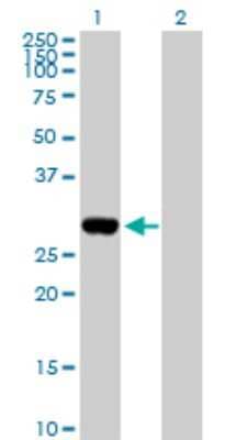 Western Blot: Dlx1 Antibody [H00001745-D01P] - Analysis of DLX1 expression in transfected 293T cell line by DLX1 polyclonal antibody.Lane 1: DLX1 transfected lysate(27.30 KDa).Lane 2: Non-transfected lysate.