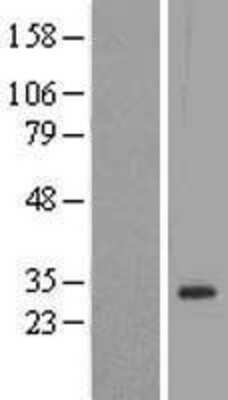 Western Blot: Dlx1 Overexpression Lysate (Adult Normal) [NBL1-09916] Left-Empty vector transfected control cell lysate (HEK293 cell lysate); Right -Over-expression Lysate for Dlx1.