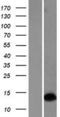 Western Blot: Dlx1 Overexpression Lysate (Adult Normal) [NBP2-09198] Left-Empty vector transfected control cell lysate (HEK293 cell lysate); Right -Over-expression Lysate for Dlx1.