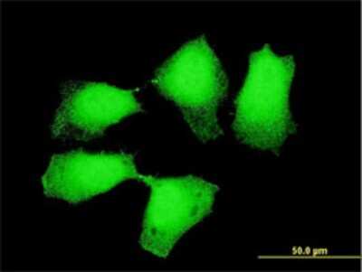 Immunocytochemistry/Immunofluorescence: Dnd1 Antibody (1D3) [H00373863-M10] - Analysis of monoclonal antibody to DND1 on HeLa cell. Antibody concentration 10 ug/ml