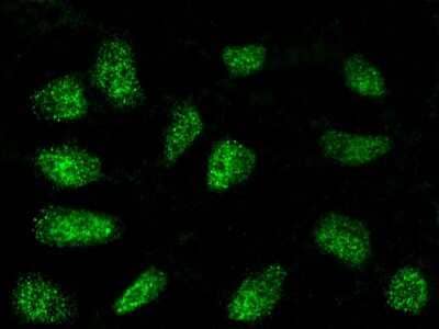 Immunocytochemistry/Immunofluorescence: Dnmt2 Antibody [NBP2-98992] - Immunofluorescence staining of Dnmt2 in HeLa cells. Cells were fixed with 4% PFA, permeabilzed with 0.3% Triton X-100 in PBS, blocked with 10% serum, and incubated with rabbit anti-Human Dnmt2 polyclonal antibody (dilution ratio 1:5000) at 4C overnight. Then cells were stained with the Alexa Fluor$488-conjugated Goat Anti-rabbit IgG Secondary antibody (green). Positive staining was localized to nucleus.