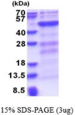 SDS-Page: Dnmt3L Recombinant Protein [NBP2-51647] - 15% SDS Page (3 ug)