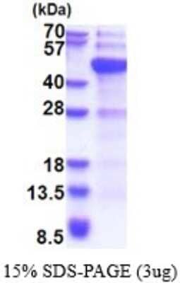 SDS-Page: Dnmt3L Recombinant Protein [NBP2-51708] - 15% SDS Page (3 ug)