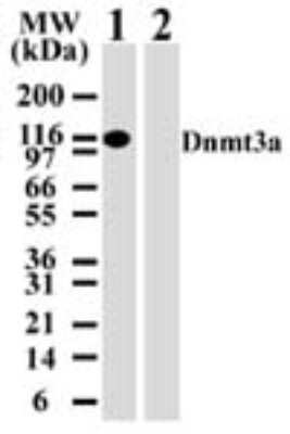 Western Blot: Dnmt3a Antibody (64B814.1) [Biotin] [NB100-55782] - WB analysis for Dnmt3a using NB100-55782 at 2 ug/ml against 10 ug of 293 cell lysate transfected with either mouse Dnmt3a (Lanes 1) or mouse Dnmt3b (Lanes 2).