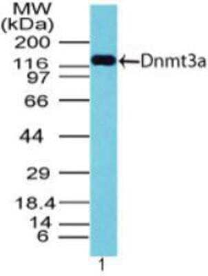Western Blot: DNMT3A Antibody [NBP2-03985] - Analysis of DNMT3A in transfected 293 cell lysate using NBP2-03985 at 1 ug/ml. Goat anti-rabbit Ig HRP secondary antibody  and  ECL substrate solution were used for this test.