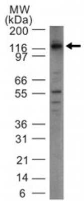 Western Blot: DNMT3A Antibody [NBP2-03987] - Dnmt3a Antibody [NBP2-03987] - Analysis using Dnmt3a antibody at 5 ug/ml with Dnmt3a transfected 293 cell lysate .