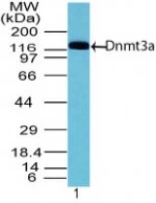 Western Blot: DNMT3A Antibody [NBP2-24471] - Dnmt3a Antibody [NBP2-24471] - Analysis of Dnmt3a in Dnmt3a transfected 293 cell lysate using NBP2-24471 at 1 ug/mL. Goat anti-rabbit Ig HRP secondary antibody and PicoTect ECL substrate solution were used for this test.