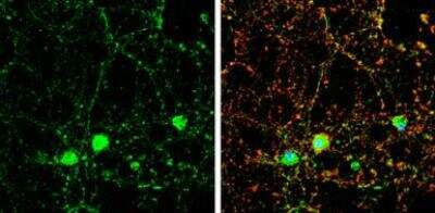 Immunocytochemistry/Immunofluorescence: Doc2-alpha Antibody [NBP2-16209] - DOC2A antibody [N2C3] detects DOC2A protein by immunofluorescent analysis.Sample: DIV9 rat E18 primary cortical neuron cells were fixed in 4% paraformaldehyde at RT for 15 min. Green: DOC2A stained by DOC2A antibody [N2C3] diluted at 1:500. Red: beta Tubulin 3/ Tuj1, stained by beta Tubulin 3/ Tuj1 antibody [GT1338] diluted at 1:500. Blue: Fluoroshield with DAPI.