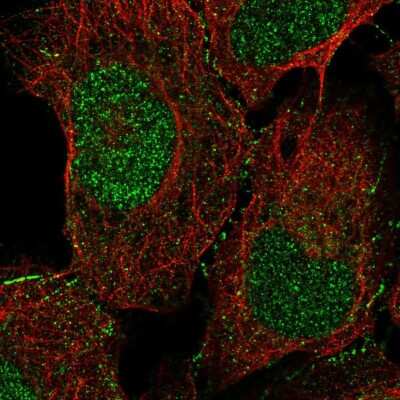 Immunocytochemistry/Immunofluorescence: Doc2-alpha Antibody [NBP2-55903] - Staining of human cell line U-2 OS shows localization to nucleus & cell junctions. Antibody staining is shown in green.