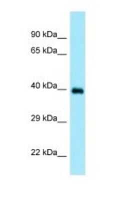 Western Blot: Doc2-alpha Antibody [NBP1-98544] - Titration: 1.0 ug/ml Positive Control: Placenta.