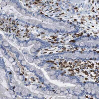 Immunohistochemistry-Paraffin: Dock5 Antibody [NBP1-83627] - Staining of human colon shows moderate to strong cytoplasmic positivity in peripheral leukocytes.
