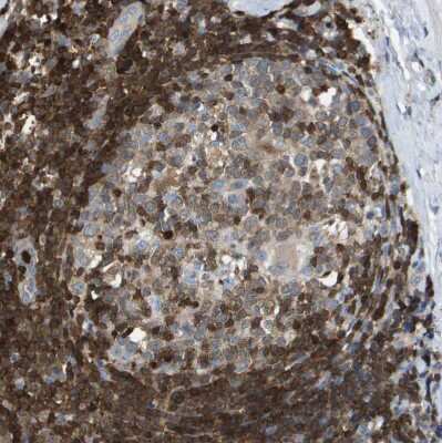 Immunohistochemistry-Paraffin: Dock5 Antibody [NBP1-83627] - Staining of human tonsil shows strong cytoplasmic positivity in non-germinal center cells.