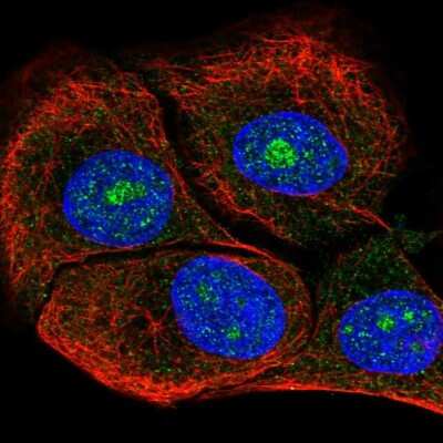 Immunocytochemistry/ Immunofluorescence Dolichol Kinase Antibody