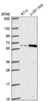 Western Blot Dolichol Kinase Antibody