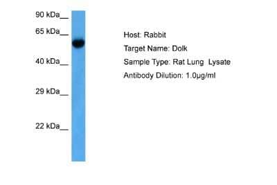 Western Blot: Dolichol Kinase Antibody [NBP2-84812] - Host: Rabbit. Target Name: DOLK. Sample Tissue: Rat Lung lysates. Antibody Dilution: 1.0ug/ml