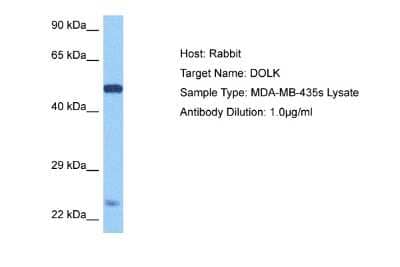 Western Blot: Dolichol Kinase Antibody [NBP2-84813] - Host: Rabbit. Target Name: DOLK. Sample Tissue: Human MDA-MB-435s lysates. Antibody Dilution: 1ug/ml