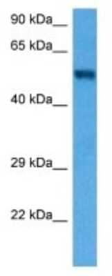 Western Blot Dolichol Kinase Antibody