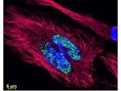 Immunocytochemistry/Immunofluorescence: Donkey anti-Mouse IgG (H+L) Secondary Antibody (Pre-adsorbed) [NB120-7056] - Using the DyLight 488 format of this antibody.