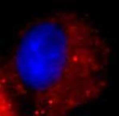 Immunocytochemistry/Immunofluorescence: Donkey anti-Rabbit IgG (H+L) Secondary Antibody [DyLight 594] [NBP1-75632] - Analysis of NS4B in HeLa cells using Donkey anti-Rabbit IgG (H+L) Secondary Antibody [DyLight 594]. Cells were fixed in 4% paraformaldehyde for 20 minutes at room temperature. Image from verified customer review.