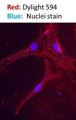 Immunocytochemistry/Immunofluorescence: Donkey anti-Rabbit IgG (H+L) Secondary Antibody [DyLight 594] (Pre-adsorbed) [NBP1-75642] - Analysis of human osteosarcoma cell using Donkey anti-Rabbit IgG (H+L) Secondary Antibody [DyLight 594] (Pre-adsorbed). Image from verified customer review.