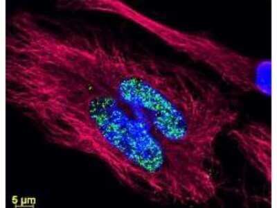 Immunocytochemistry/Immunofluorescence: Donkey anti-Rabbit IgG (H+L) Secondary Antibody (Pre-adsorbed) [NBP1-72741] - Immunocytochemistry/Immunofluorescence: Donkey anti-Rabbit IgG (H+L) Secondary Antibody [DyLight 488] (Pre-absorbed) [NBP1-72966] Image from the DyLight 488 version of this antibody.