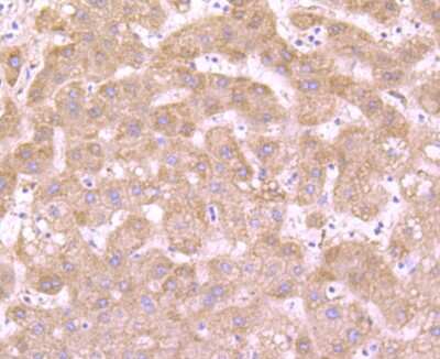 Immunohistochemistry-Paraffin: Dopa Decarboxylase/DDC Antibody (JA53-16) [NBP2-66806] - Analysis of paraffin-embedded human liver tissue using anti-DOPA Decarboxylase antibody. Counter stained with hematoxylin.