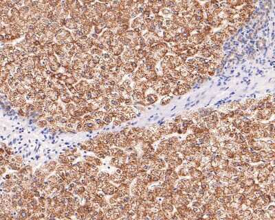 Immunohistochemistry-Paraffin: Dopa Decarboxylase/DDC Antibody (JA53-16) [NBP2-66806] - Analysis of paraffin-embedded human liver tissue with Rabbit anti-DOPA Decarboxylase antibody washed with ddH2O and PBS, and then probed with the primary antibody  at 1/400 dilution for 1 hour at room temperature. The detection was performed using an HRP conjugated compact polymer system. DAB was used as the chromogen. Tissues were counterstained with hematoxylin and mounted with DPX.